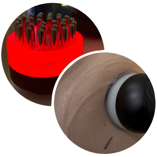 cavitation+biophone